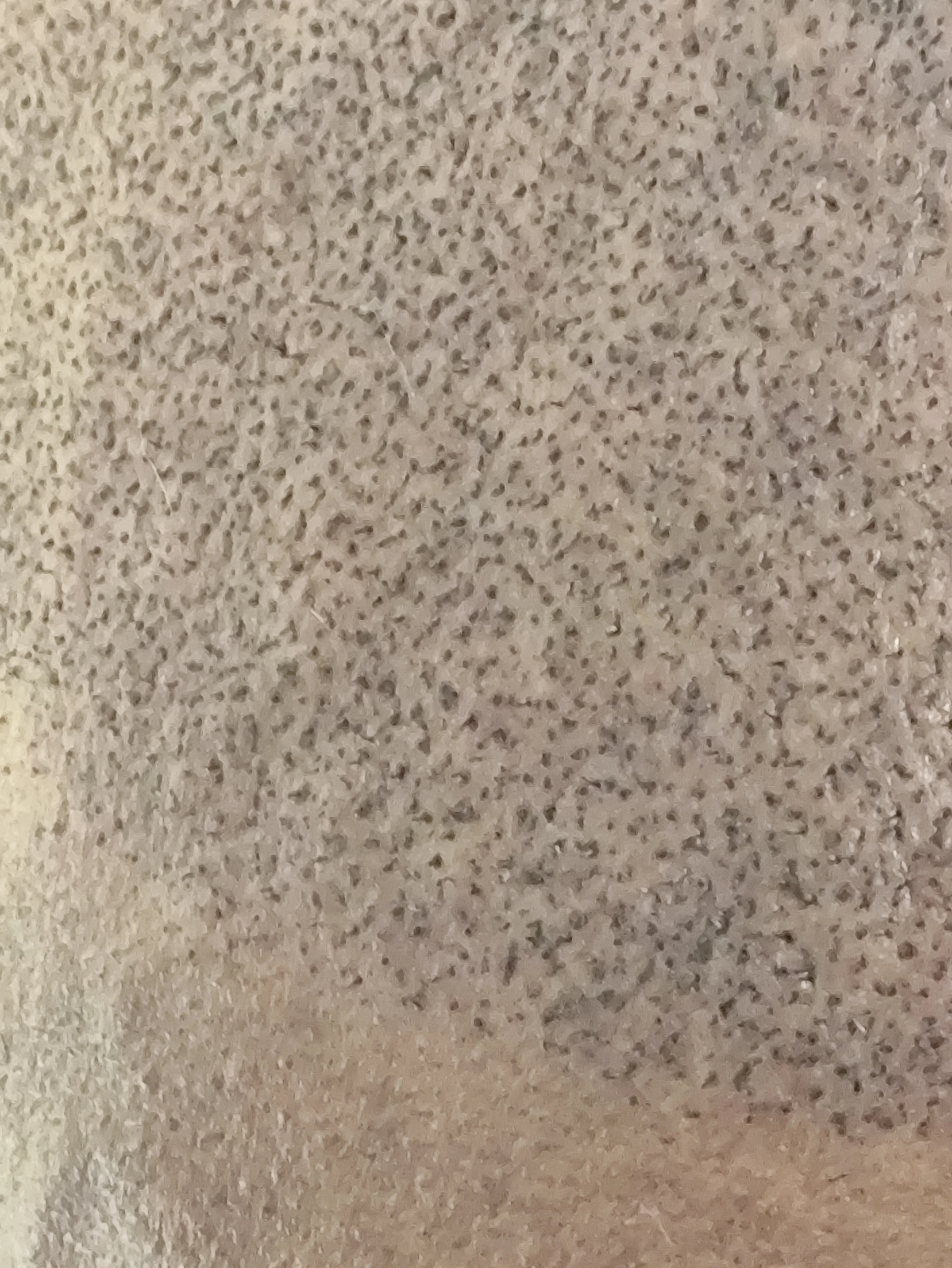 Mahammed full head scalp micropigmentation dark skin Kent — final result