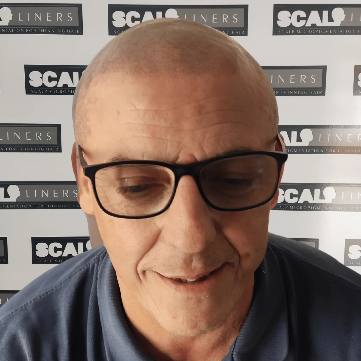 Wayne full head SMP result Whitstable Kent — final result